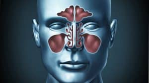 Sinusitis_Anatomy_a03